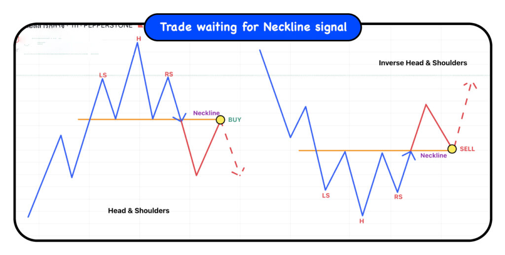 h&s pattern Neckline Eng